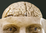 Brain Trauma